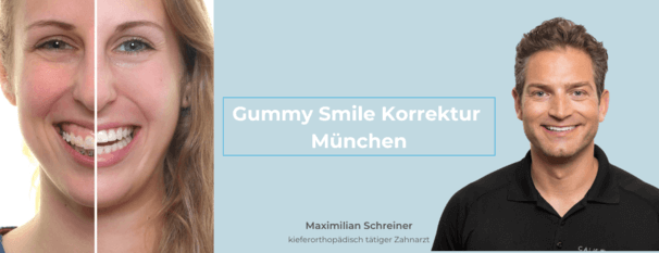 gummy-smile-muenchen-maximilian-schreiner-t.png 