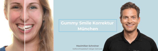 gummy-smile-muenchen-maximilian-schreiner.png 