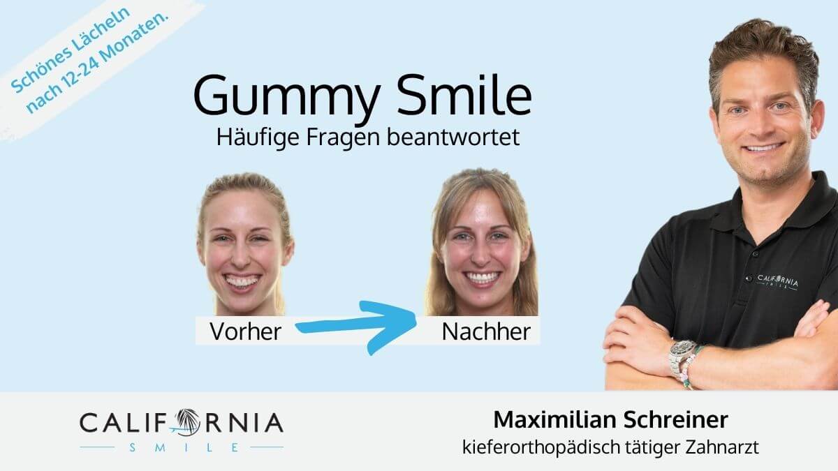 California Smile Maximilian Schreiner Gummy Smile